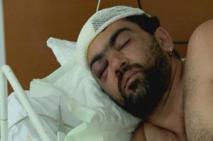 Ilustračné foto: Jeden z vážne zranených aktérov hromadnej bitky leží v nemocnici. (Foto: TVNOVINY.sk)